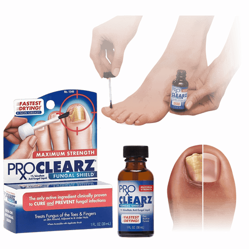 ProX Clearz